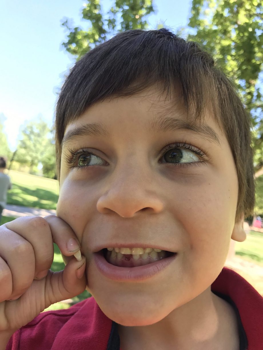 Jack Lost His First Tooth